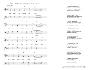 Hymn score of: Are there no wounds for me? (Grace Webster Hinsdale/Johannes Thomas Rüegg)